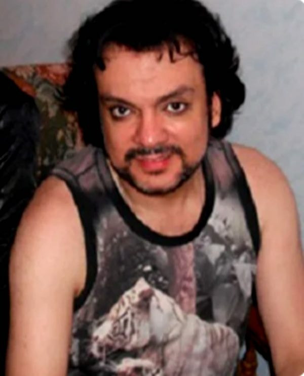 Matyt, tai priklauso nuo amžiaus. Juk Kirkorovui jau 52 metai. Maždaug šiame amžiuje vyrai pradeda plikti. Deja, dainininkė šios problemos neišvengė. Mes, žinoma, to nepastebime, nes dainininkė naudoja peruką.   Tačiau atostogų metu Filipas šio aksesuaro atsisako. Ir tada ant jo galvos jau matosi plikė.