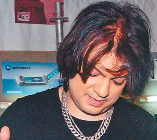 Matyt, tai priklauso nuo amžiaus. Juk Kirkorovui jau 52 metai. Maždaug šiame amžiuje vyrai pradeda plikti. Deja, dainininkė šios problemos neišvengė. Mes, žinoma, to nepastebime, nes dainininkė naudoja peruką.   Tačiau atostogų metu Filipas šio aksesuaro atsisako. Ir tada ant jo galvos jau matosi plikė.