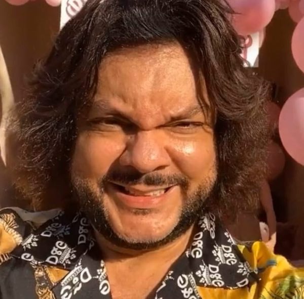 Matyt, tai priklauso nuo amžiaus. Juk Kirkorovui jau 52 metai. Maždaug šiame amžiuje vyrai pradeda plikti. Deja, dainininkė šios problemos neišvengė. Mes, žinoma, to nepastebime, nes dainininkė naudoja peruką.   Tačiau atostogų metu Filipas šio aksesuaro atsisako. Ir tada ant jo galvos jau matosi plikė.