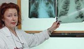 Tuberkuliozės ignoravimas - kelias į epidemiją 