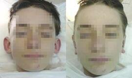 Atlėpusių ausų klijuoti neverta 