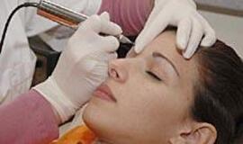 Įsiverti papuošalo - su raštišku tėvų sutikimu 