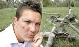 Kanberoje kengūra užpuolė žmogų