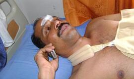 "Air India Express" keleiviai pasakojo, kaip jiems pavyko išsigelbėti