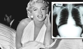 Marilyn Monroe rentgeno nuotraukos parduotos už 45 tūkst. dolerių