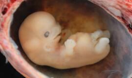 Seime - ginčai dėl lytinių ląstelių donorystės ir embrionų šaldymo