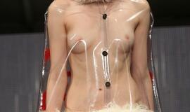 Mada Londone: kraujas, dujokaukės, genitalijos...