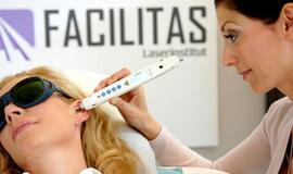 Lietuvos rūkaliams mesti rūkyti padės lazeris