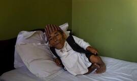 54,6 cm ūgio nepalietis - mažiausias žmogus pasaulyje