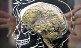 Pasaulį matome skirtingai