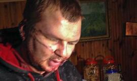 "Automaidano" lyderis Dmitro Bulatovas: mane mušė kiekvieną dieną