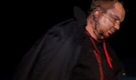 Dmitro Bulatovas atskrido gydytis į Vilnių