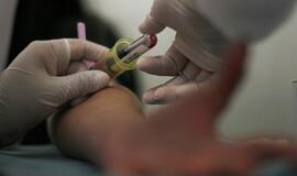 Hepatito A protrūkiai Europos šalyse specialistams kelia nerimą