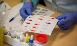 Vienas donoras - trys išgelbėti žmonės