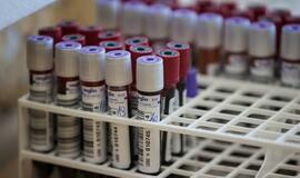 Vienas donoras - trys išgelbėti žmonės