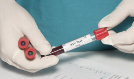 Specialistai: Lietuvoje keičiasi ŽIV plitimo tendencijos