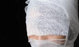 Debreceno gatvėje puldinėjamos moterys