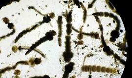 Ispanijoje pirmą kartą gimė Zika užsikrėtęs kūdikis