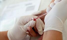 Iki 2018 metų atidėta Hepatito registro veikla