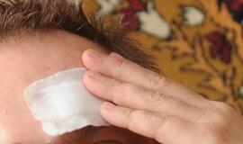 Apiplėšti iš baro Kalnupės g. ėję broliai