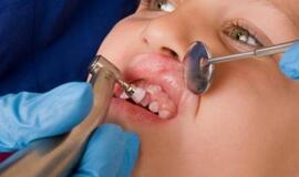 Odontologė: šventinius saldumynus padėjus į šalį, metas susirūpinti vaikų dantimis