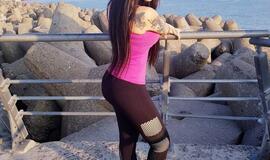 Džiaugiasi "brazilišku užpakaliuku" - pasididino sėdmenis