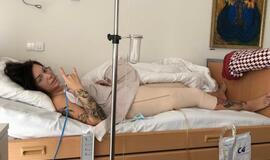 Džiaugiasi "brazilišku užpakaliuku" - pasididino sėdmenis