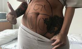 Džiaugiasi "brazilišku užpakaliuku" - pasididino sėdmenis