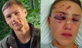 Darbas statybose Mindaugui baigėsi tragiškai: liko be akies