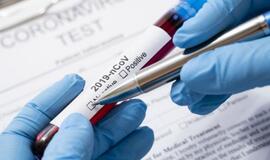 Meras: Klaipėdoje nustatyti dar trys atvejai