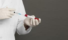 Patvirtinti dar 4 užsikrėtimo koronavirusine infekcija (COVID-19) atvejai – iš viso 537