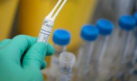 Savaitgalį didžiuosiuose miestuose planuojama tirti atsitiktinius žmones