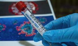 JAV per parą nustatyta daugiau kaip 55 tūkst. COVID-19 atvejų