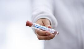 Mokamus koronaviruso testus galima atlikti 5 laboratorijose