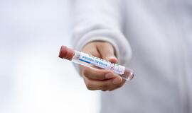 Per parą šalyje nustatyti 4 nauji atvejai