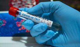 Dėl COVID-19 Klaipėdoje tirs intensyviau