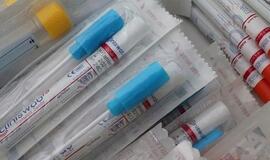 Dėl koronaviruso Klaipėdos rajone tirs intensyviau