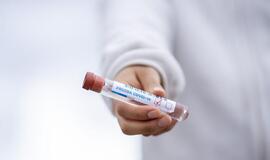 Praėjusią parą COVID-19 patvirtintas 21 žmogui