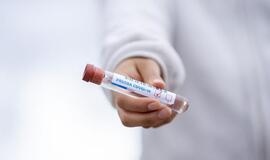 Praėjusią parą patvirtinti 36 nauji koronaviruso atvejai