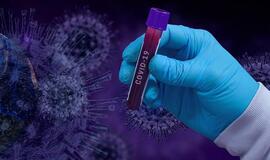 Preliminarūs duomenys: 2270 naujų COVID-19 atvejų