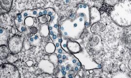 VU mokslininkai: antikūnai prieš koronavirusą išlieka pusę metų