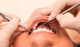 10 patarimų, kaip apsaugoti dantis šventiniu laikotarpiu