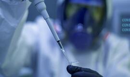 Mokslininkai nustatė genų, lemiančių didesnę tikimybę susirgti sunkios formos COVID-19