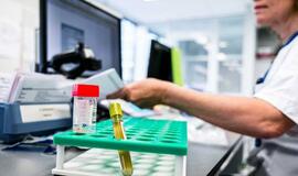 Persirgusiems COVID-19 skiepytis nėra būtina, teigia Kauno klinikų gydytoja