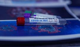 Verslo atstovai prašo valstybės paramos darbuotojų koronaviruso tyrimams