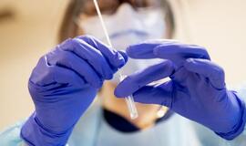 Ištyrus 5623 ėminius - 773 nauji atvejai, mirė 12 moterų ir 6 vyrai