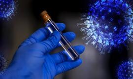 Ištyrus 6031 ėminį, 300 naujų koronaviruso atvejų, mirė 10 žmonių