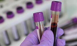 Koks gydymas apmokamas sergantiems ir persirgusiems COVID-19?