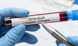 NVSC informuoja apie vasario 1 dienos COVID-19 protrūkius