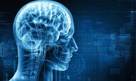 Medikai įspėja dėl smegenų sutrikimo mastų: skaičiai tik augs